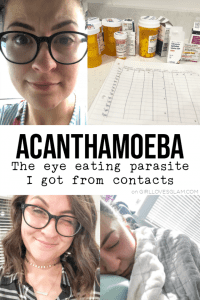 Acanthamoeba Parasite from Contacts